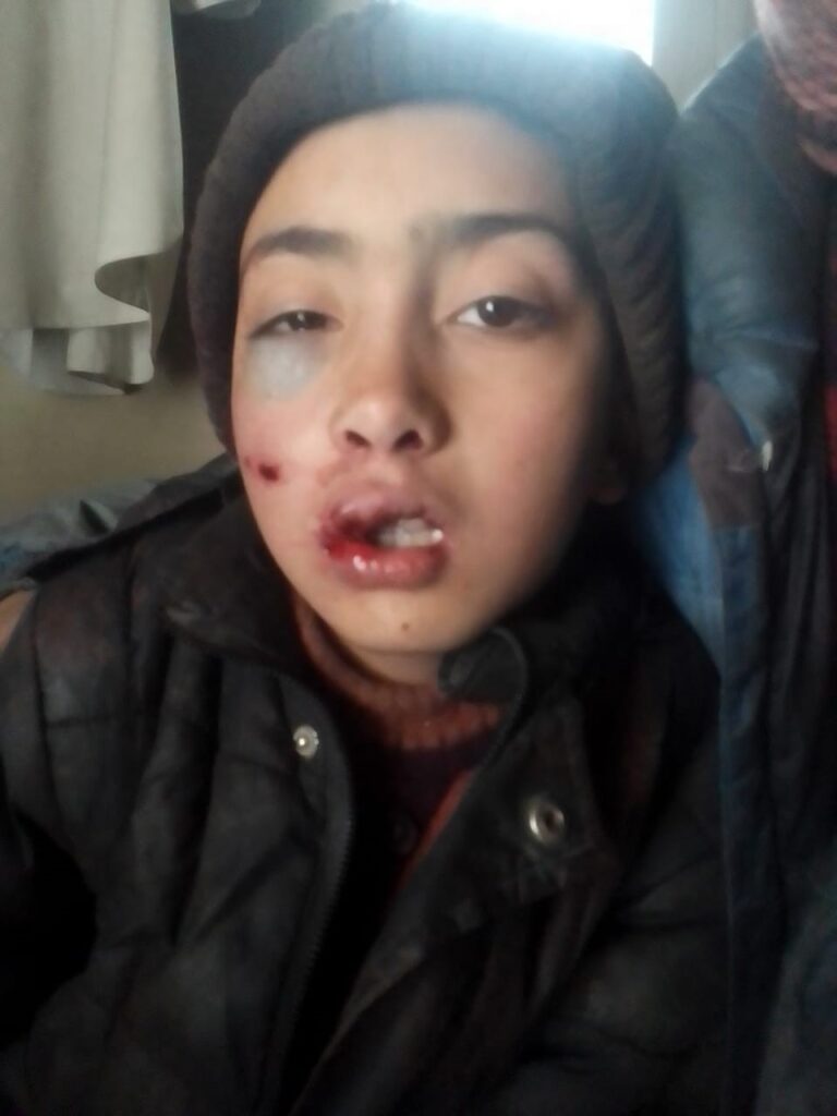 Gilgit Baltistan earthquake 5.9 magnitude affects Hunza and Chupursan Valley