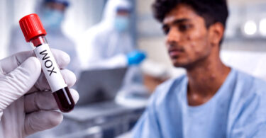 Mpox Alert: Rising Cases in Sindh, A Comprehensive Guide to Symptoms, Spread, and Prevention